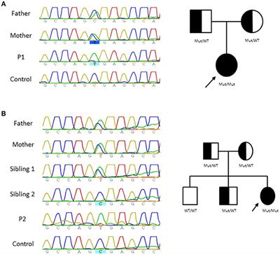 Extreme Phenotypes With Identical Mutations: Two Patients With Same Non-sense NHEJ1 Homozygous Mutation